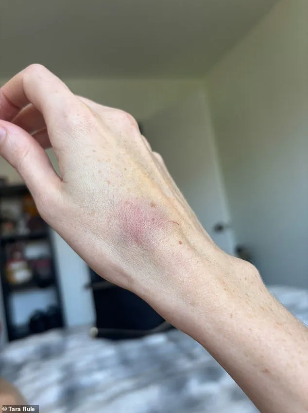 Limited Access to Medical Information Sparks Airline Dispute Involving Influencer with EDS