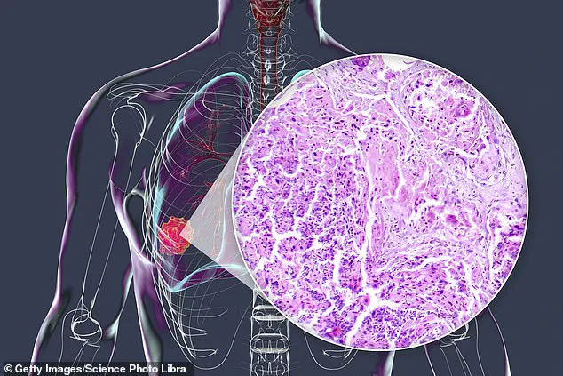 From Worm Medicine to Cancer Cure: How a 40-Year-Old Drug's New Form Could Revolutionize Treatment