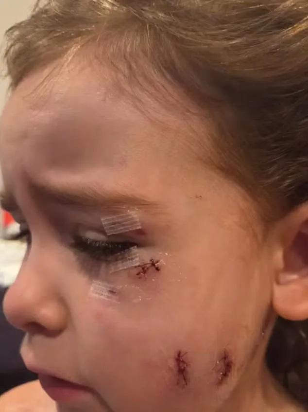 Brutal Attack by Escaped Bulldogs in Oshawa Leaves Two Mothers and Child Injured, Owners Unbothered by Chaos